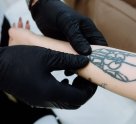 Студия лазерного удаления татуировок
