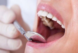 Лечение кариеса двух и более зубов со скидкой