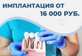 Имплантация от 16000 рублей!