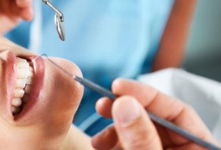 Терапевтическое лечение зубов