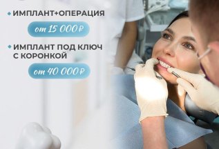 Имплантация под ключ 40 тысяч рублей