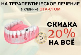 Скидка на лечение зубов 20% для взрослых пациентов