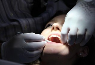 АКЦИЯ на удаление зуба всего от 2650