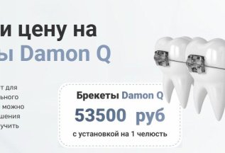 Брекеты Damon Q 53500 руб. с установкой на 1 челюсть