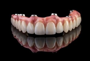 Акция на имплантацию зубов Straumann под ключ за 74 960 руб!