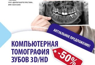 Компьютерная томография зубов