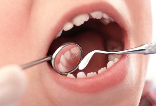 Лечение кариеса на молочном зубе -5000 руб
