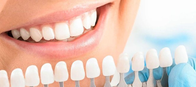 Профессиональное отбеливание зубов Amazing White