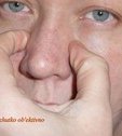 Консультация по ринопластике