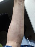 Порезы на руках