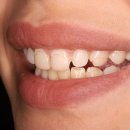 Стоматология Доктора Хачатуряна Best Smile Clinic (Бест смайл клиник)