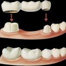 Dentium (Дентиум)