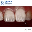 ДЕЛЬТА