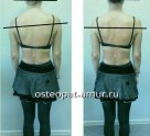 Лечения опорно-двигательного аппарата
