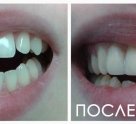 Респект