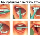 Медиа