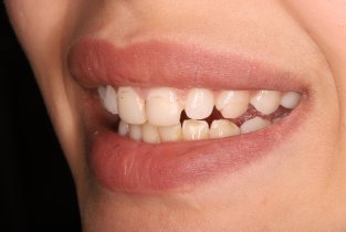 Стоматология Доктора Хачатуряна Best Smile Clinic (Бест смайл клиник)