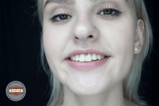 Estetica