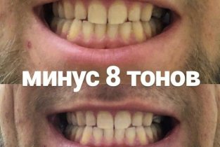 Студия отбеливания зубов White & Smile Kaliningrad