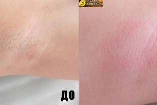 Кабинет депиляции