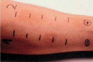 Allergo clinic