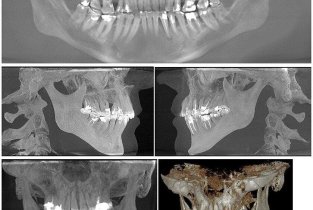 Независимый томографический центр челюстно-лицевой области