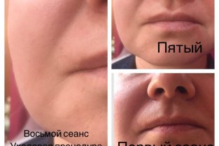 Бьюти