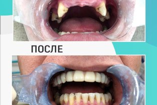 Центр дентальной имплантологии на Лесной улице в Королёве