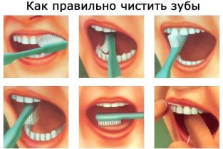 Медиа