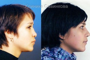 Доктора Савинкова