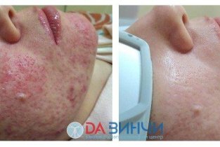 ДАВИНЧИ