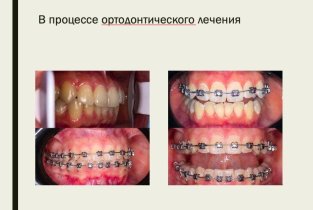 Клиника реконструктивной стоматологии