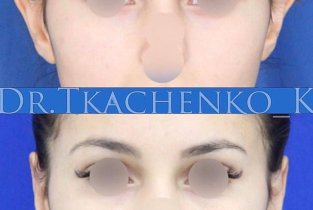 Dr. Tkachenko_K