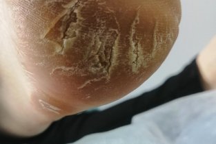 Семейной подологической помощи