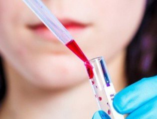 Какой анализ крови показывает онкологию и причем здесь ДНК?