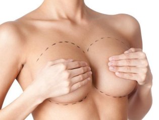 Тренд пластической хирургии 2016 года: липофилинг груди