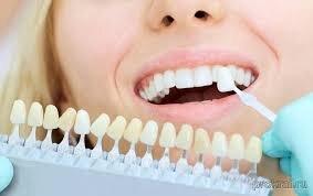 Консультация стоматолога-ортопеда бесплатно!