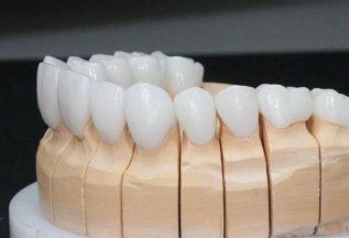 Имплантация зубов под ключ всего за 52000 рублей!