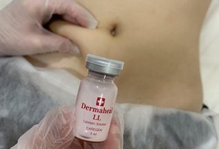 Курс липолитиков Mesoline: худейте выгодно!