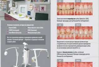 Zoom 4 – система профессионального отбеливания зубов.