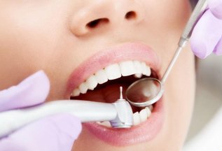 Лечение зубов в рассрочку, по индивидуальным условиям.