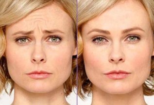 💉 Морщины? Забудь надолго — Botox от 290 ₽ за ед.!