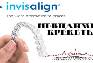 Невидимые брекеты (INVISALIGN) от 200 000 руб.