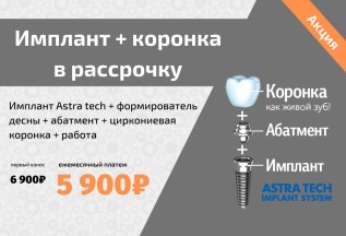 Имплант Astra Tech + циркониевая коронка в рассрочку