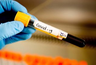 Уникальный экспресс-тест на антитела к COVID-19