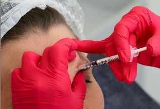 -15% на ботулинотерапию и филлер с гиалуроновой кислотой
