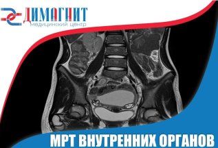 МРТ брюшной полости от 4050 рублей