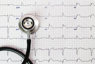 Бесплатно-ЭКГ с расшифровкой при первичном приеме кардиолога