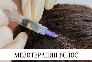 Мезотерапия волос