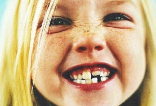 Прием врача-стоматолога детского первичный - 1500 руб.